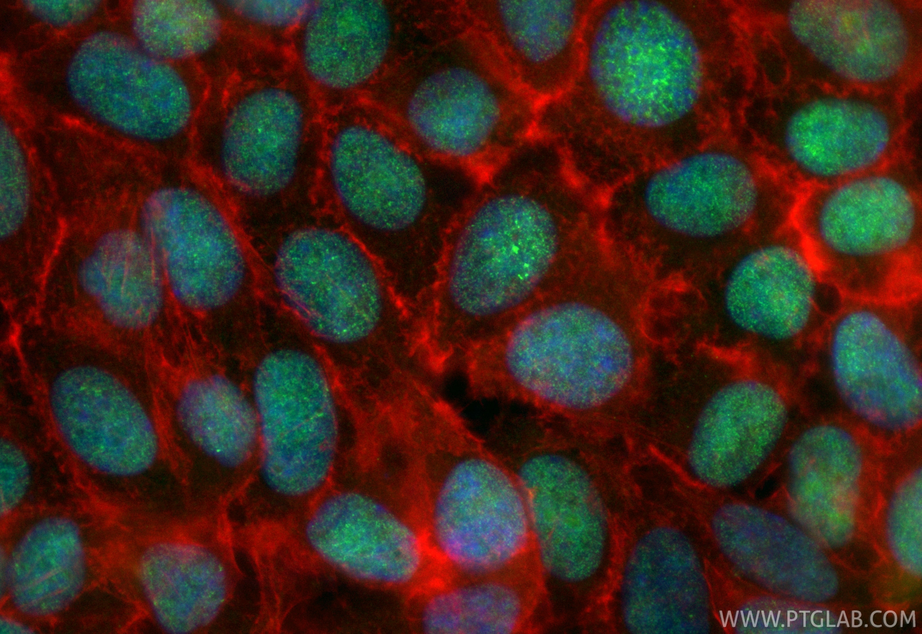 Immunofluorescent analysis of (4% PFA) fixed MCF-7 cells using CoraLite® Plus 488 SENP3 antibody (CL488-85837-3, Clone: 250153A9 ) at dilution of 1:200, CL594-Phalloidin (red). Immunofluorescence (IF) / fluorescent staining of MCF-7 cells using CoraLite® Plus 488-conjugated SENP3 Recombinant mo (CL488-85837-3)