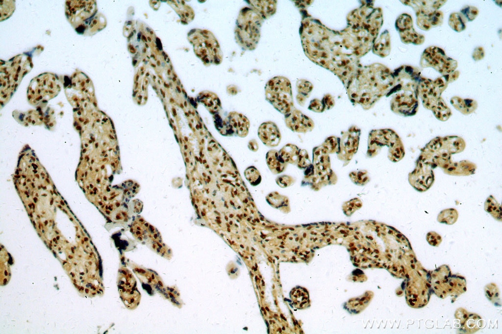 Immunohistochemistry (IHC) staining of human placenta tissue using SENP5-Specific Polyclonal antibody (19529-1-AP)