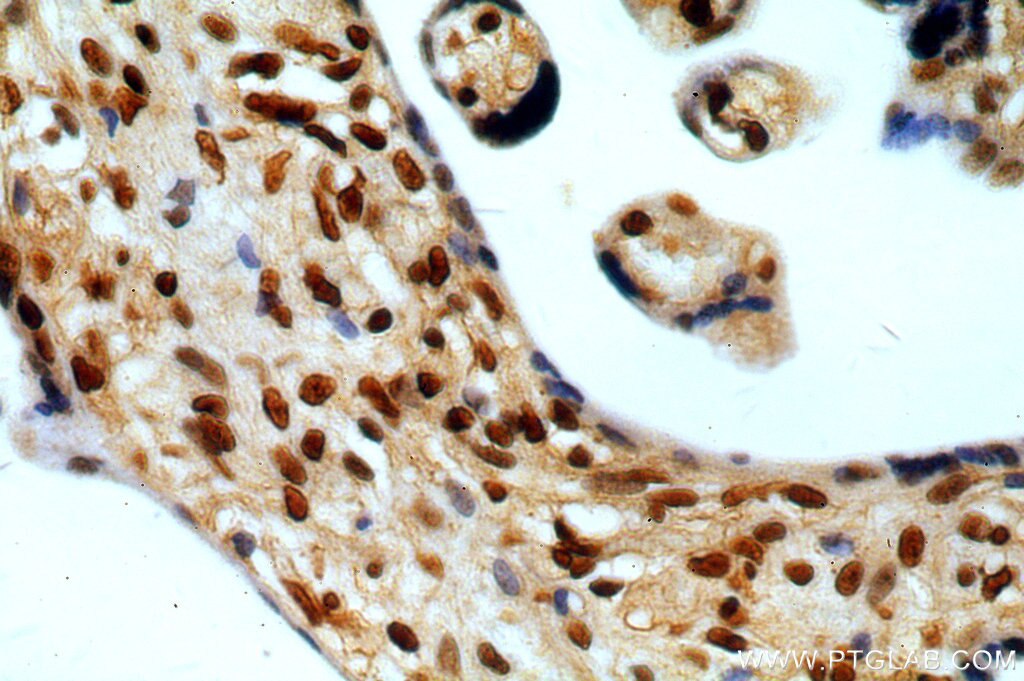 Immunohistochemistry (IHC) staining of human placenta tissue using SENP5-Specific Polyclonal antibody (19529-1-AP)
