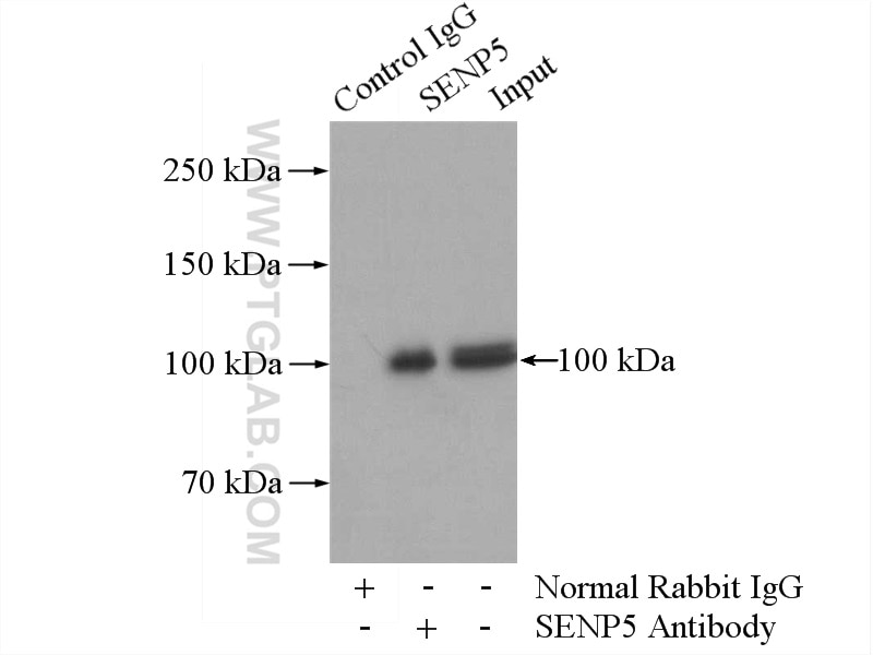Immunoprecipitation (IP) experiment of HeLa cells using SENP5-Specific Polyclonal antibody (19529-1-AP)