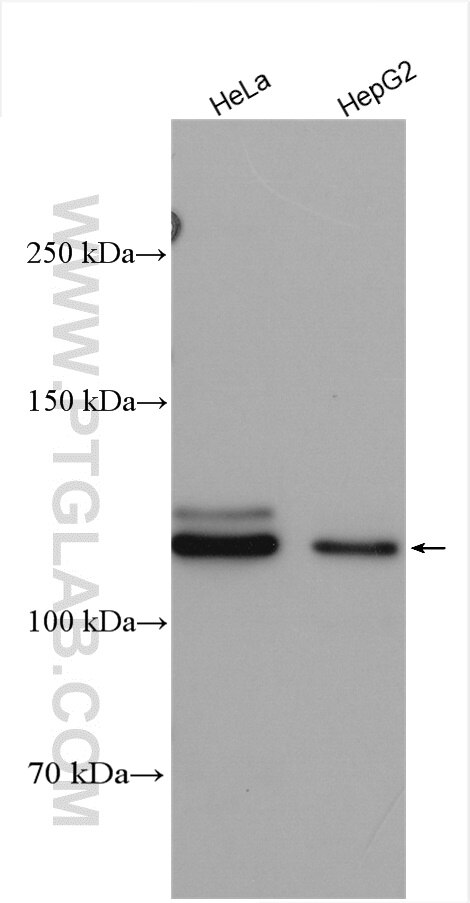 Western Blot (WB) analysis of various lysates using SENP5-Specific Polyclonal antibody (19529-1-AP)