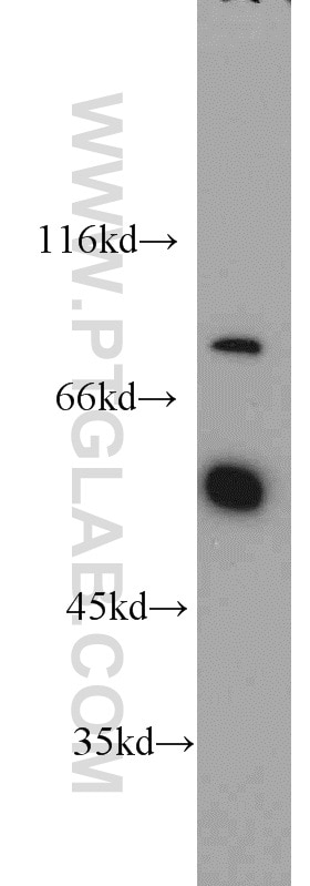 Western Blot (WB) analysis of mouse liver tissue using SENP5-Specific Polyclonal antibody (19529-1-AP)