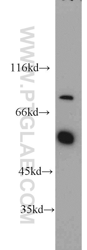 WB analysis of mouse liver using 19529-1-AP