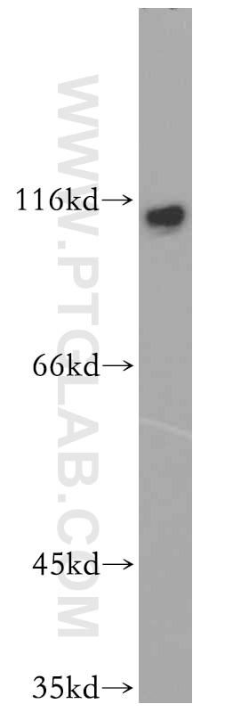 Western Blot (WB) analysis of HepG2 cells using SENP5-Specific Polyclonal antibody (19529-1-AP)