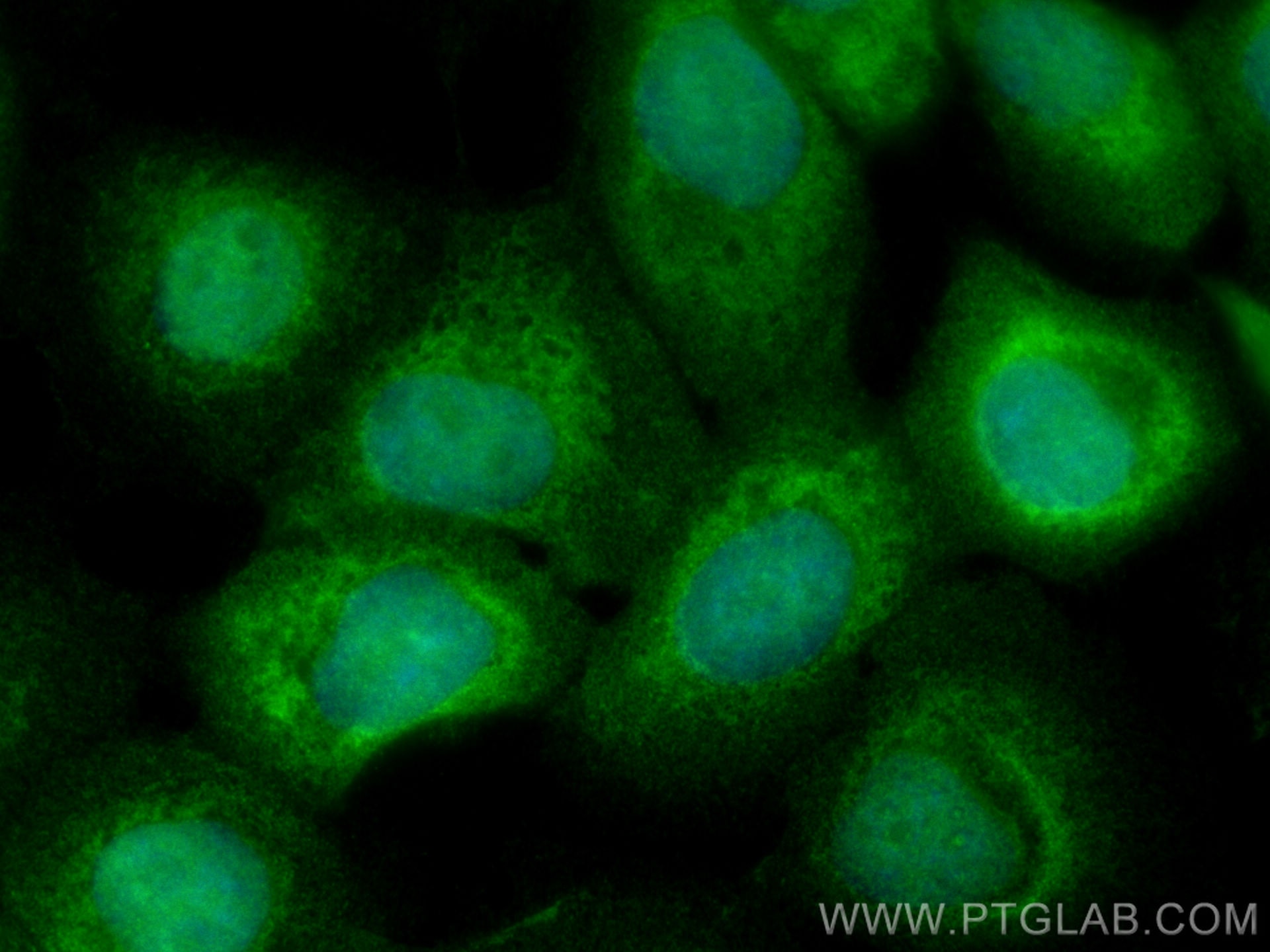 Immunofluorescence (IF) / fluorescent staining of A431 cells using SENP8 Polyclonal antibody (13479-1-AP)