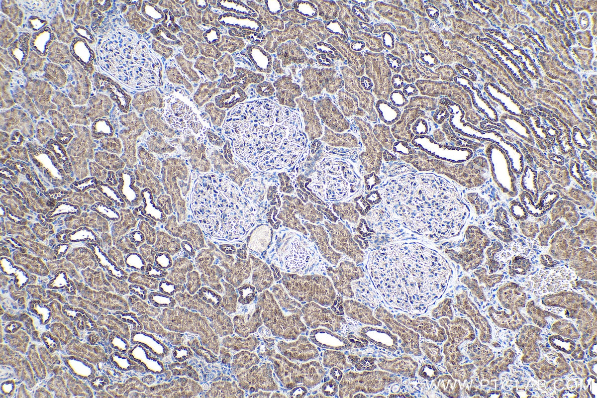 Immunohistochemistry (IHC) staining of human kidney tissue using SENP8 Polyclonal antibody (13479-1-AP)