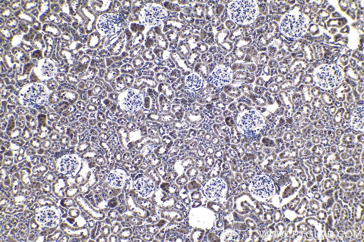 Immunohistochemistry (IHC) staining of rat kidney tissue using SENP8 Polyclonal antibody (13479-1-AP)