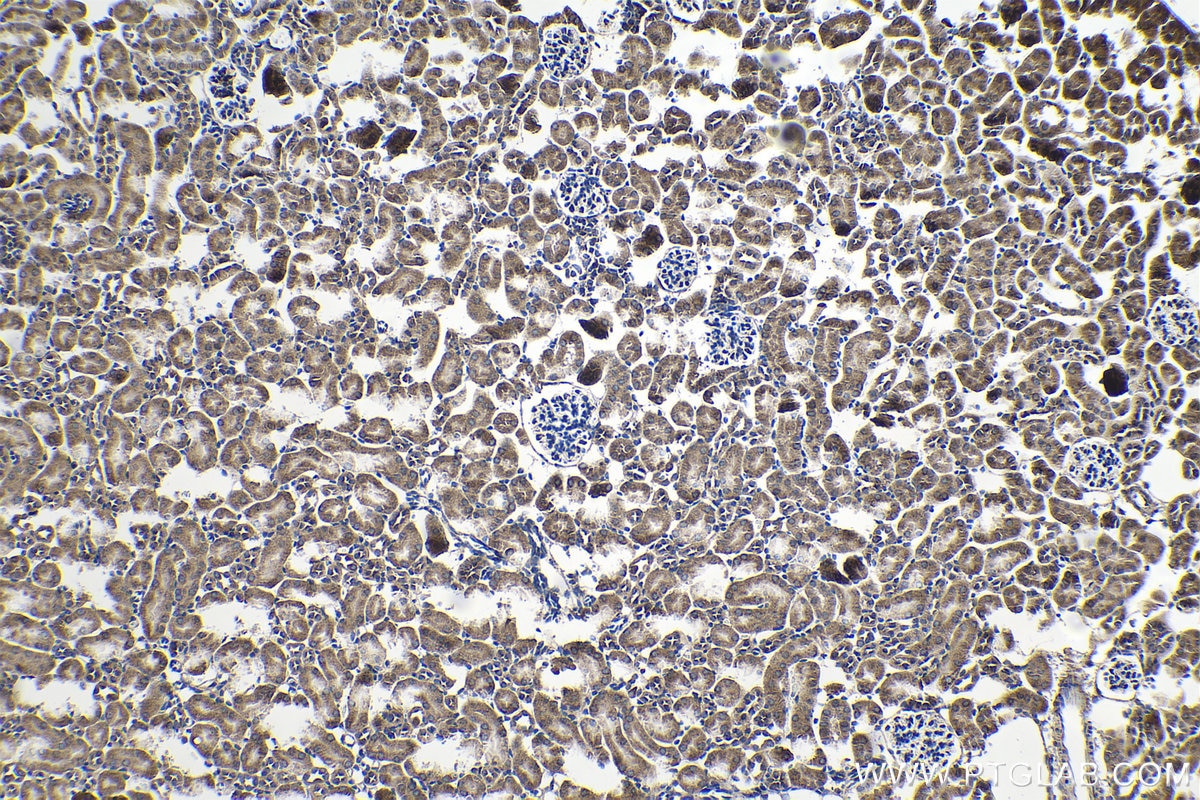Immunohistochemistry (IHC) staining of mouse kidney tissue using SENP8 Polyclonal antibody (13479-1-AP)