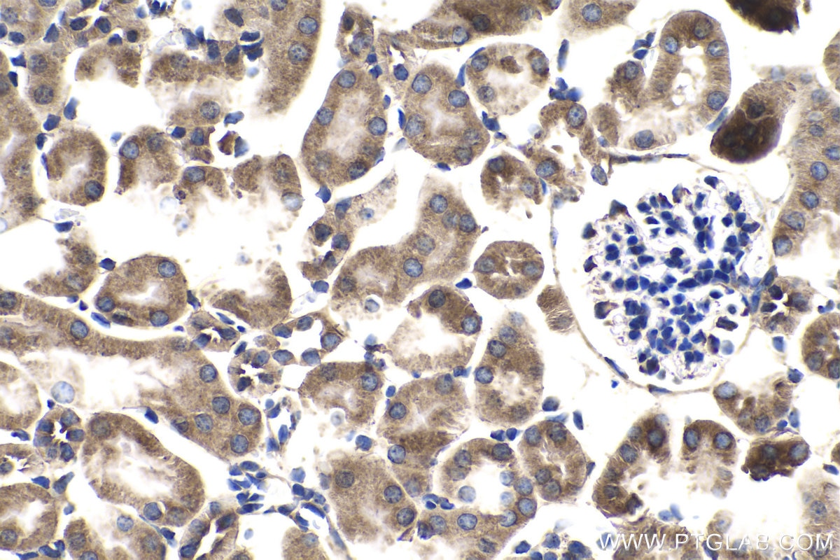 Immunohistochemistry (IHC) staining of mouse kidney tissue using SENP8 Polyclonal antibody (13479-1-AP)