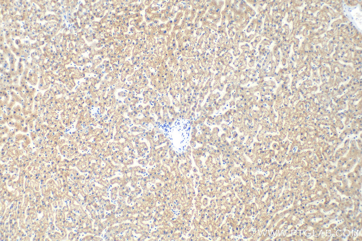 Immunohistochemistry (IHC) staining of human liver tissue using SENP8 Polyclonal antibody (13479-1-AP)