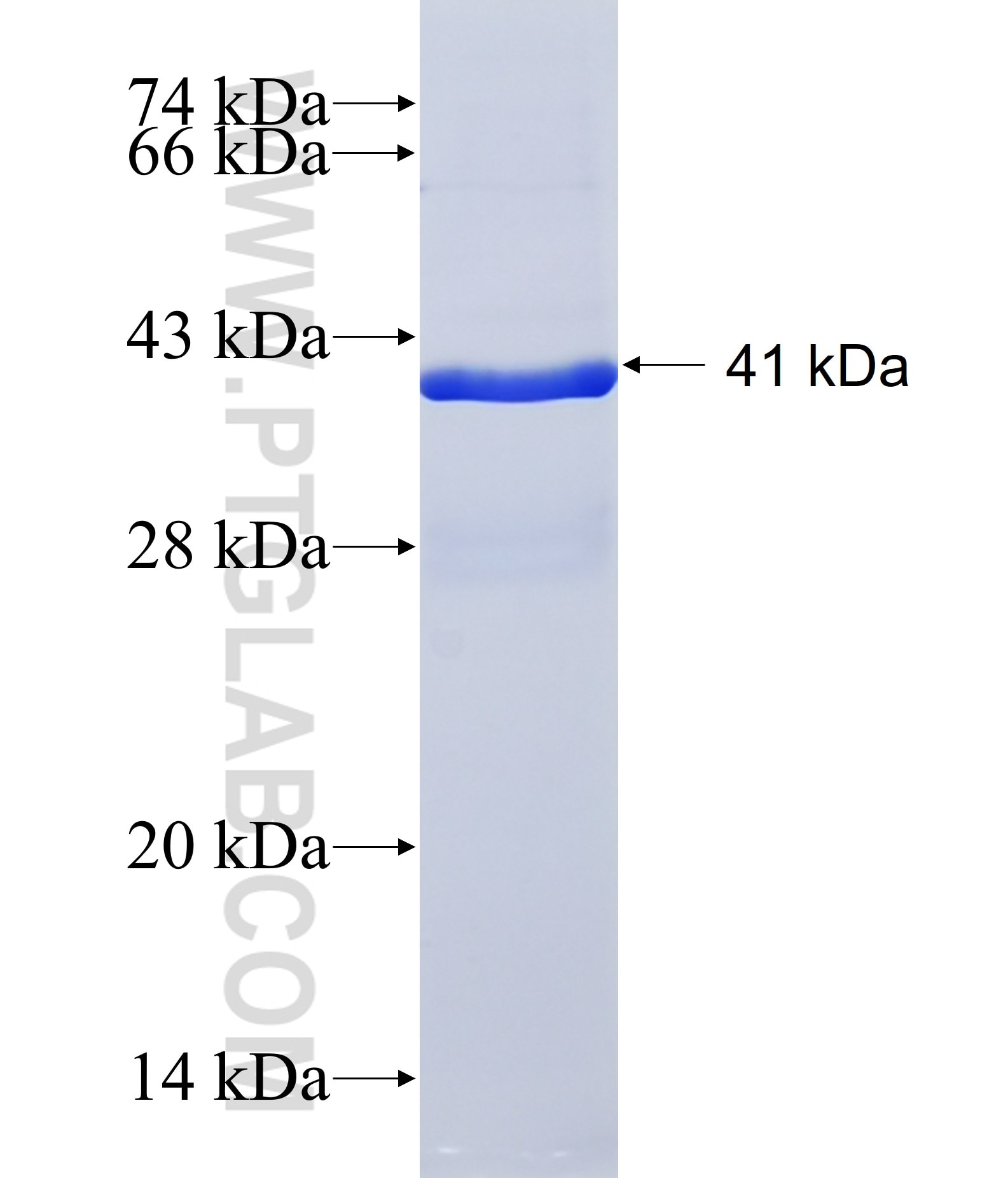 SEP15 fusion protein Ag40997 SDS-PAGE SEP15 fusion protein Ag40997 SDS-PAGE