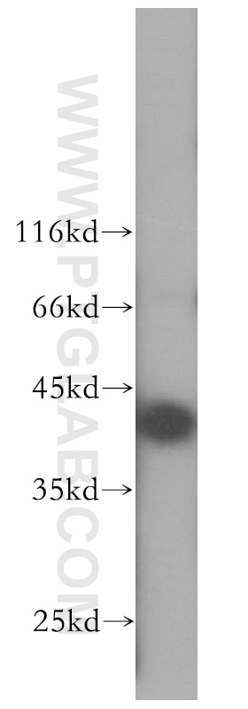 Western Blot (WB) analysis of HepG2 cells using SEPHS1 Polyclonal antibody (16635-1-AP)