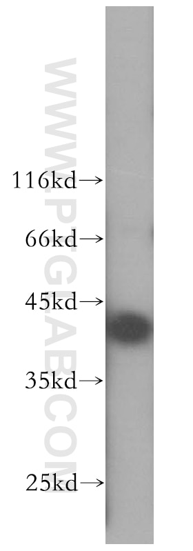 WB analysis of HepG2 using 16635-1-AP