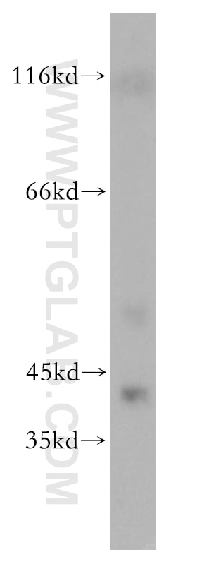Western Blot (WB) analysis of mouse liver tissue using SEPHS1 Polyclonal antibody (16635-1-AP)