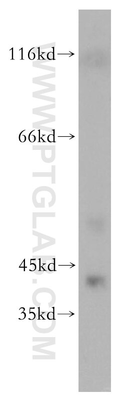 Western Blot (WB) analysis of mouse liver tissue using SEPHS1 Polyclonal antibody (16635-1-AP)