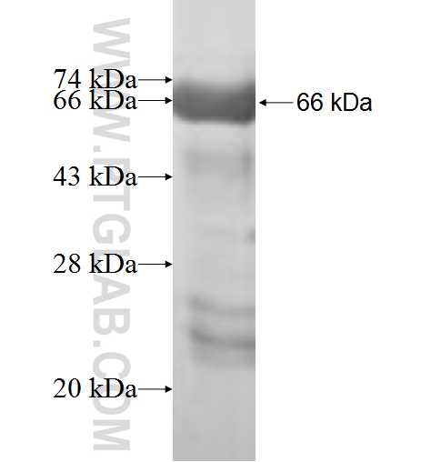 SEPHS1 fusion protein Ag9978 SDS-PAGE