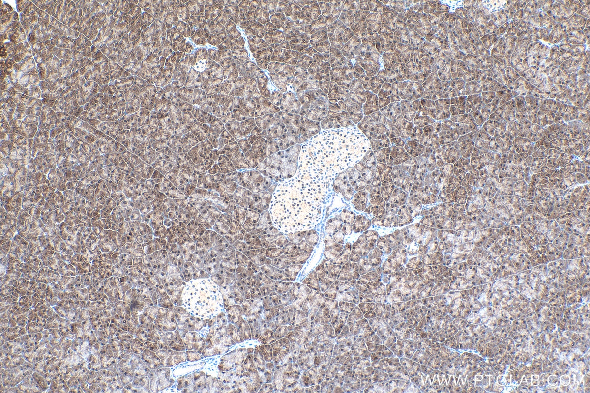 Immunohistochemistry (IHC) staining of mouse pancreas tissue using SEPHS2 Polyclonal antibody (14109-1-AP)