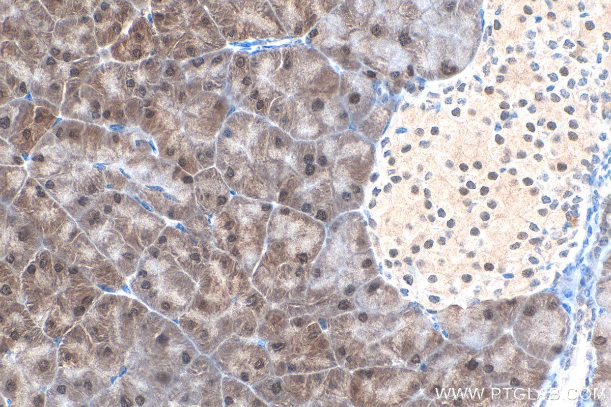 Immunohistochemistry (IHC) staining of mouse pancreas tissue using SEPHS2 Polyclonal antibody (14109-1-AP)