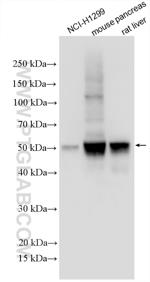 Western Blot (WB) analysis of various lysates using SEPHS2 Polyclonal antibody (14109-1-AP)