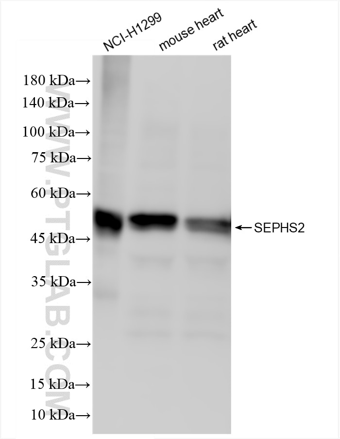 Western Blot (WB) analysis of various lysates using SEPHS2 Recombinant antibody (86443-1-RR)