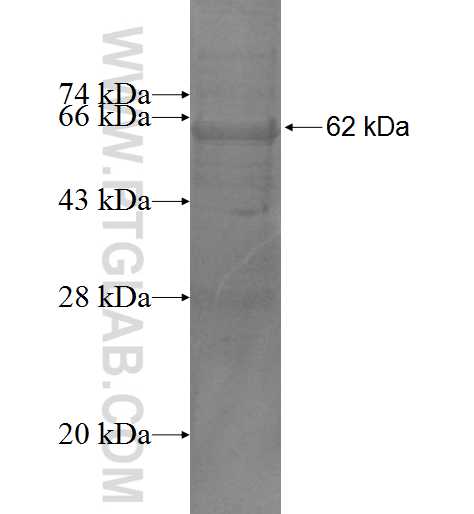 SEPHS2 fusion protein Ag5255 SDS-PAGE