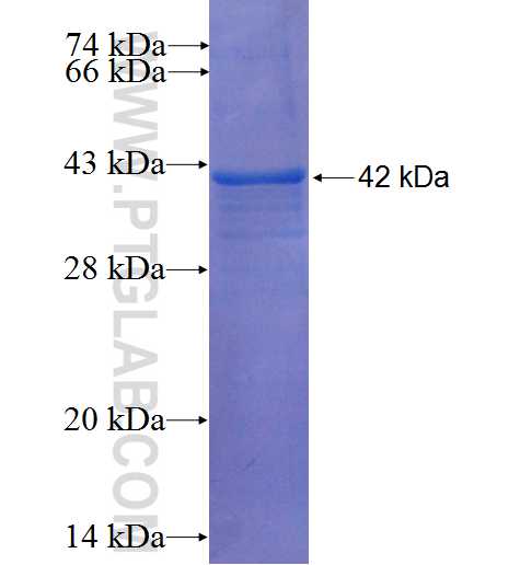 SEPHS2 fusion protein Ag5420 SDS-PAGE