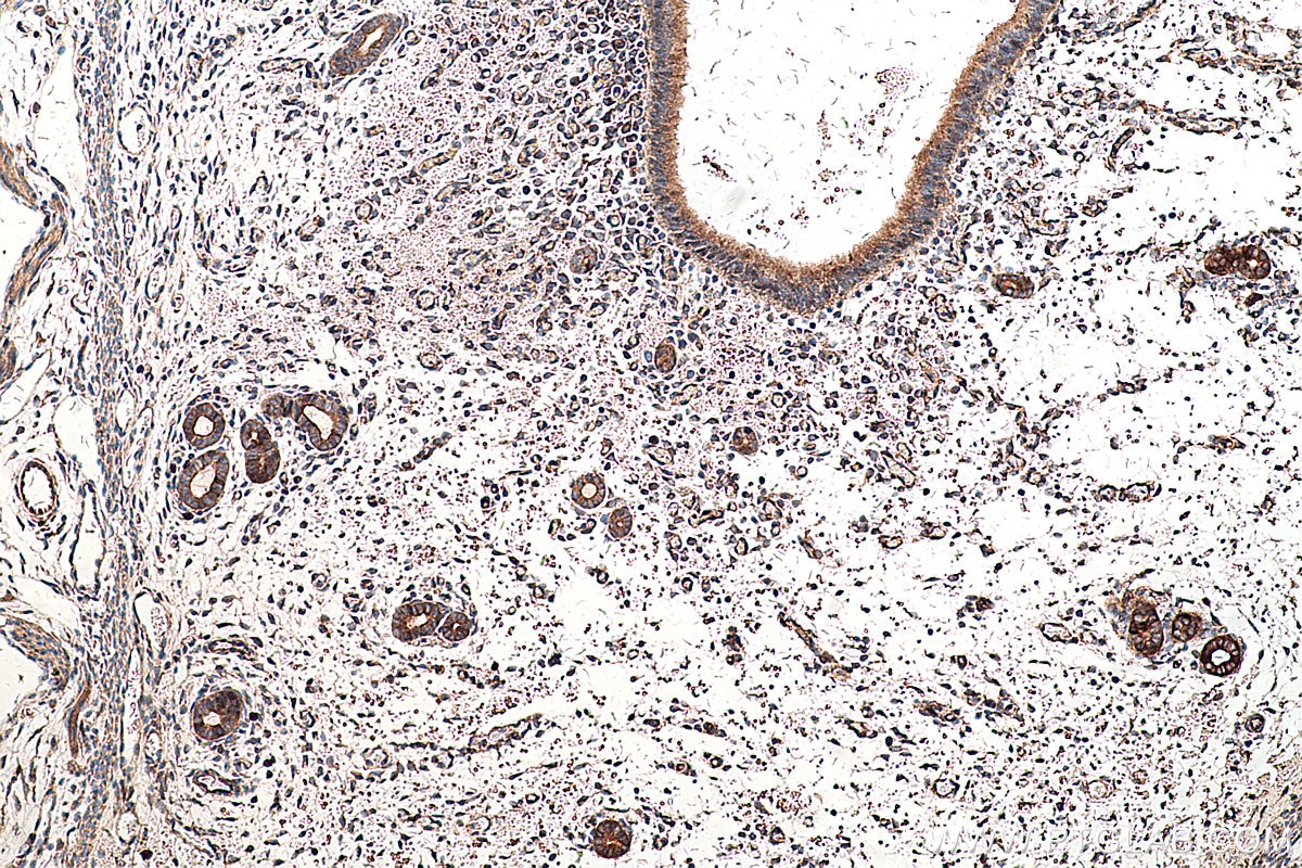 Immunohistochemistry (IHC) staining of mouse uterus tissue using SEPN1 Polyclonal antibody (55333-1-AP)
