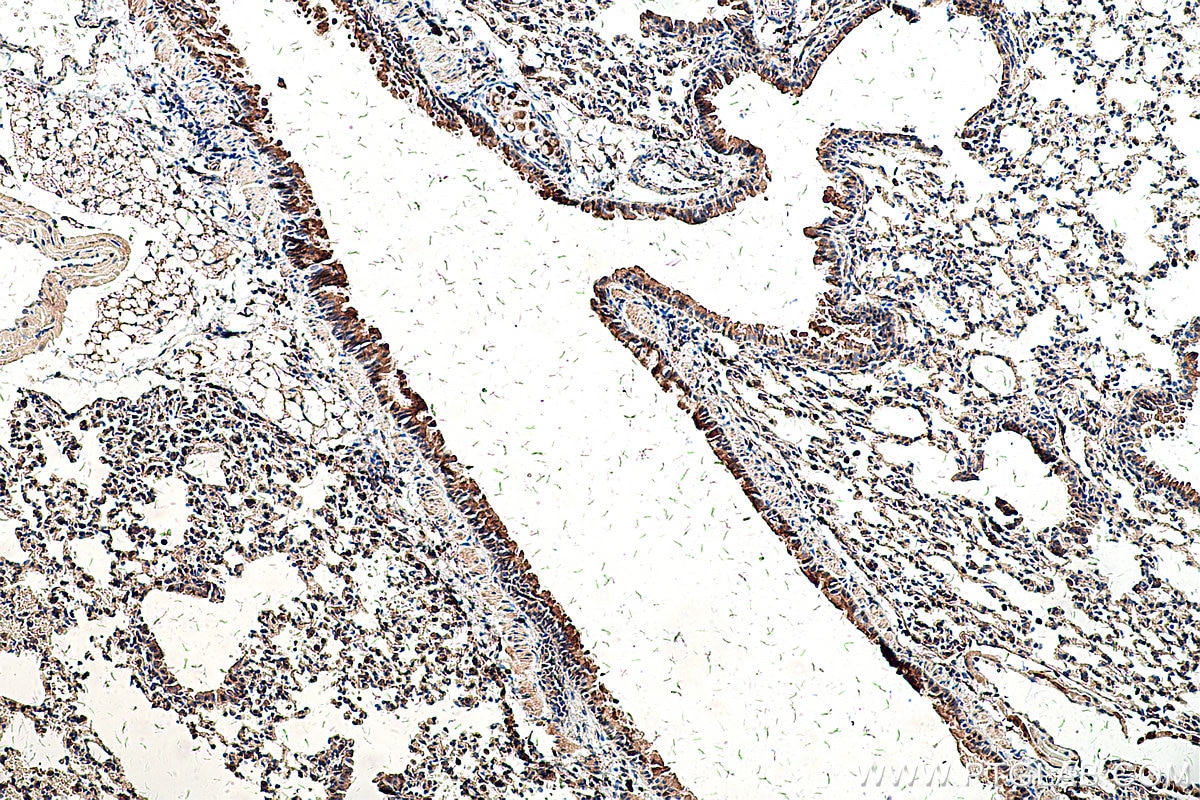 IHC staining of mouse lung using 55333-1-AP