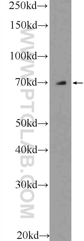 Western Blot (WB) analysis of A549 cells using SEPN1 Polyclonal antibody (55333-1-AP)