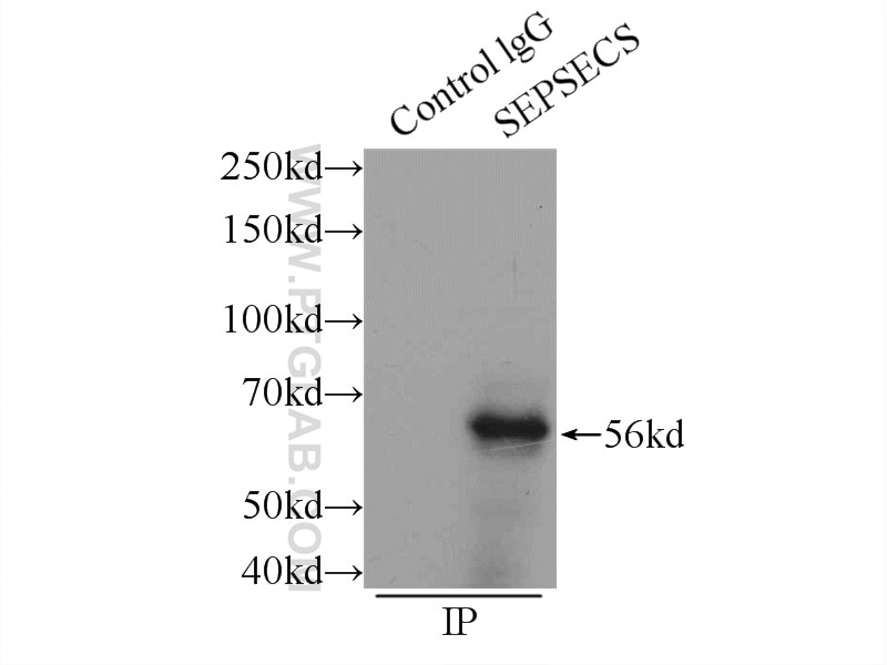 Immunoprecipitation (IP) experiment of mouse liver tissue using SLA/LP Polyclonal antibody (11551-1-AP)