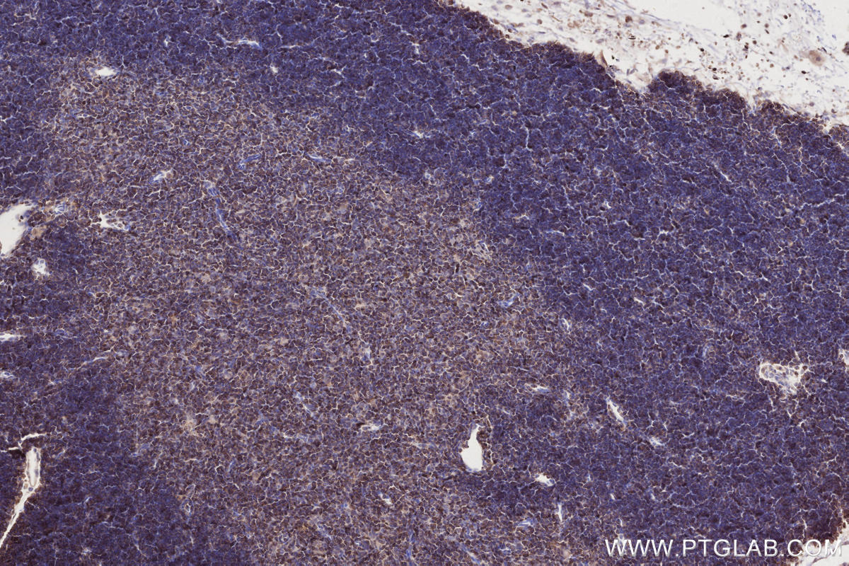 Immunohistochemistry (IHC) staining of mouse thymus tissue using Septin 1 Polyclonal antibody (11370-1-AP)