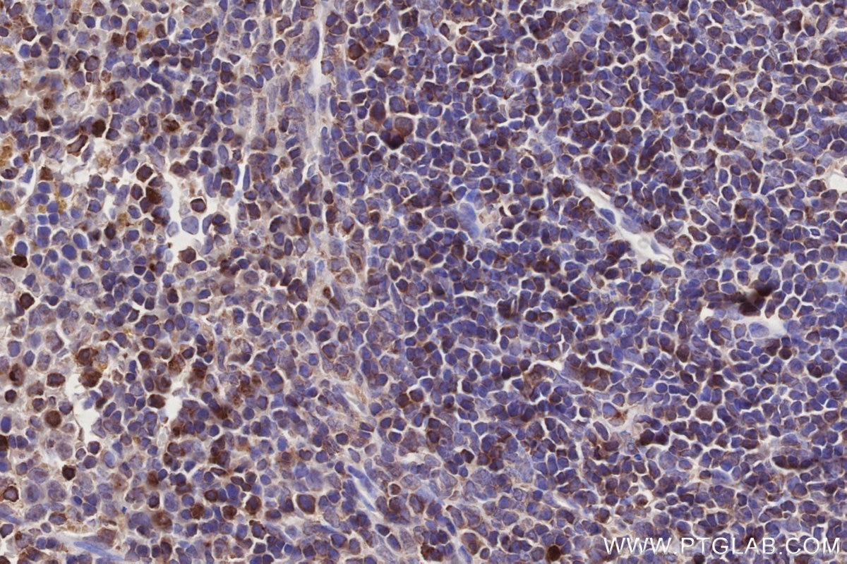 Immunohistochemistry (IHC) staining of mouse spleen tissue using Septin 1 Polyclonal antibody (11370-1-AP)