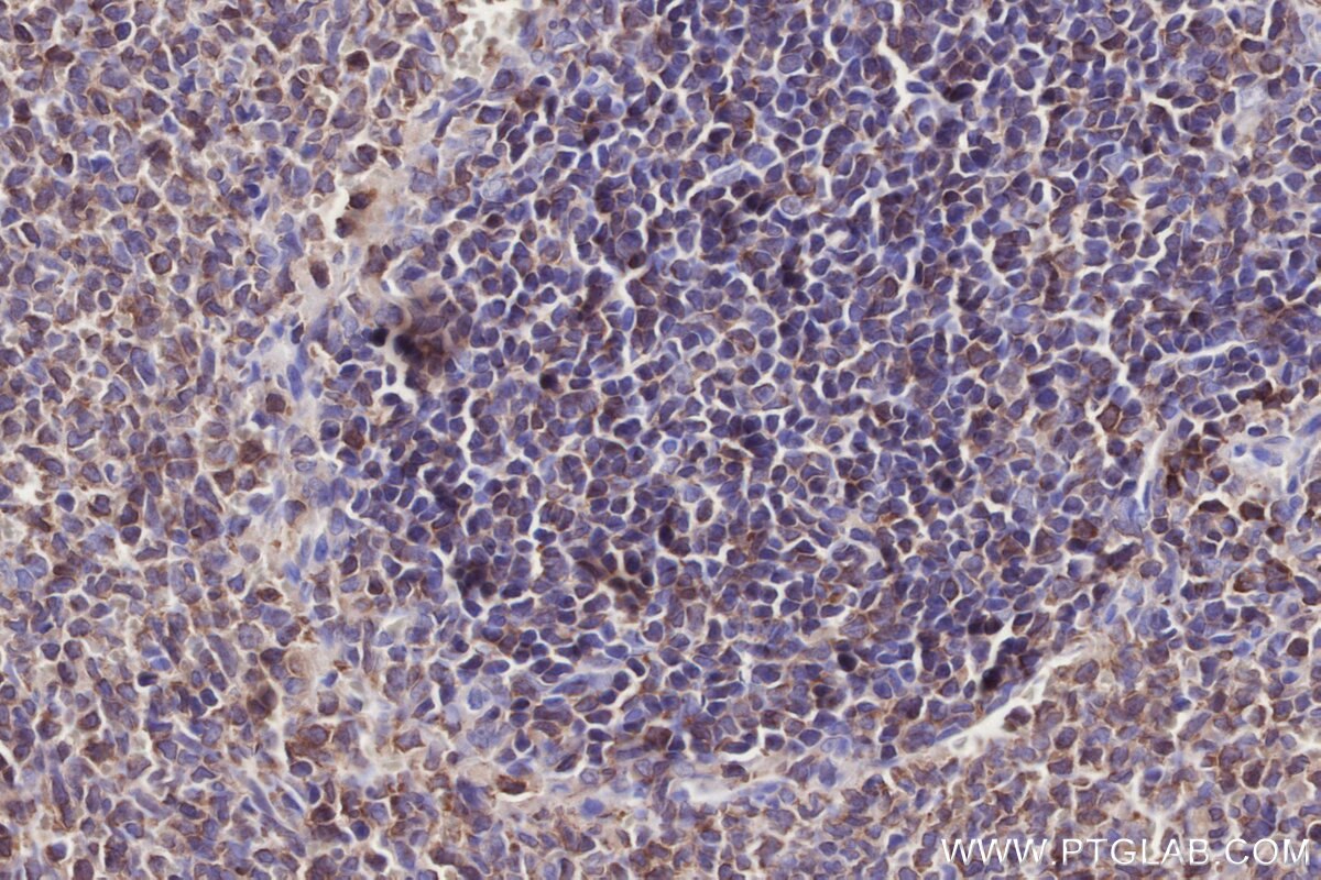 Immunohistochemistry (IHC) staining of rat spleen tissue using Septin 1 Polyclonal antibody (11370-1-AP)