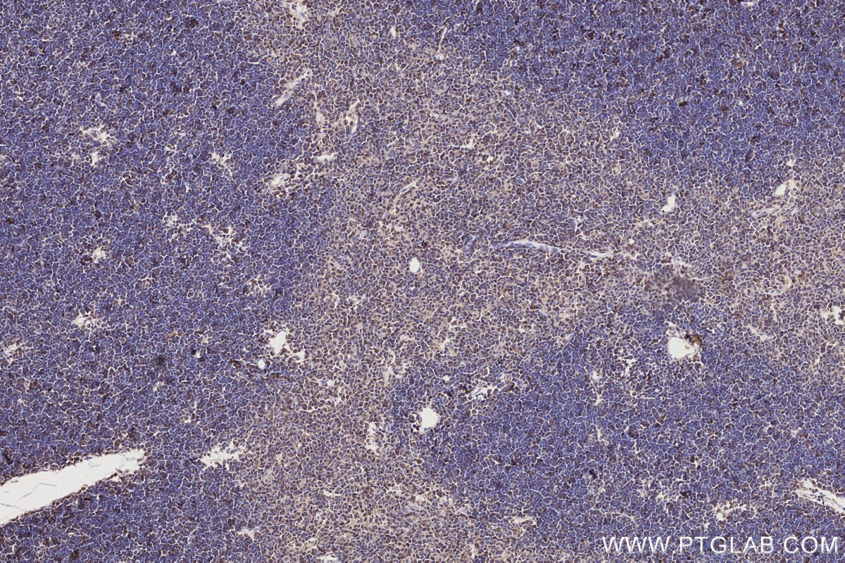 Immunohistochemistry (IHC) staining of rat thymus tissue using Septin 1 Polyclonal antibody (11370-1-AP)