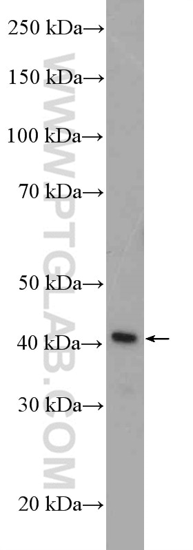 Western Blot (WB) analysis of Jurkat cells using Septin 1 Polyclonal antibody (11370-1-AP)