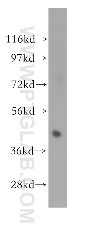 Septin 1