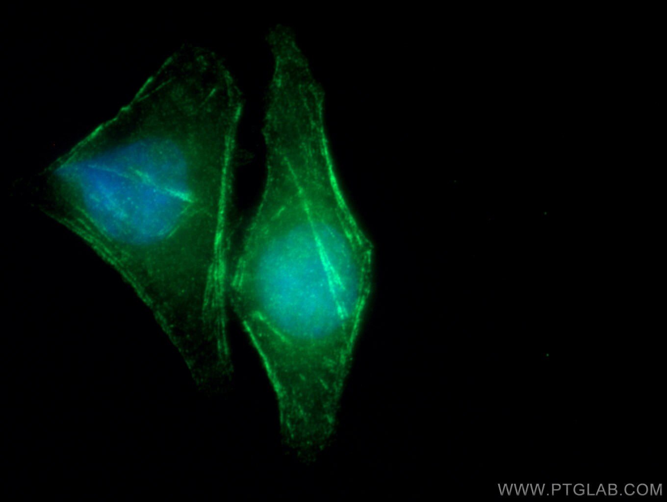 Immunofluorescence (IF) / fluorescent staining of HepG2 cells using Septin 10 Polyclonal antibody (12420-1-AP)