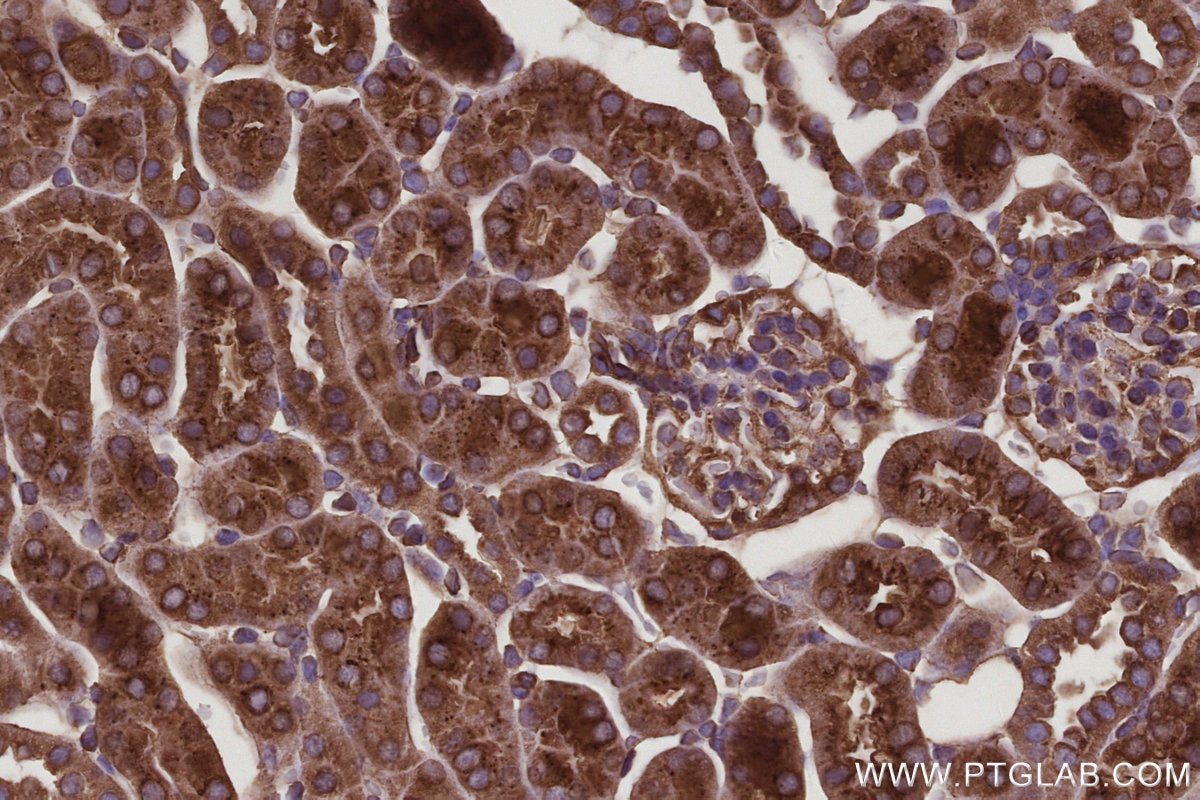 IHC staining of mouse kidney using 12420-1-AP Immunohistochemistry (IHC) staining of mouse kidney tissue using Septin 10 Polyclonal antibody (12420-1-AP)