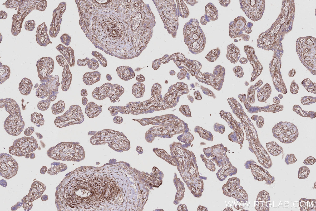 IHC staining of human placenta using 12420-1-AP Immunohistochemistry (IHC) staining of human placenta tissue using Septin 10 Polyclonal antibody (12420-1-AP)