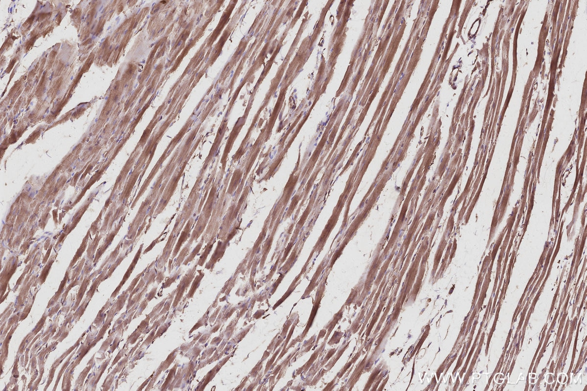 IHC staining of rat heart using 12420-1-AP Immunohistochemistry (IHC) staining of rat heart tissue using Septin 10 Polyclonal antibody (12420-1-AP)