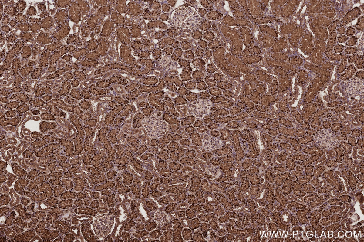 IHC staining of rat kidney using 12420-1-AP Immunohistochemistry (IHC) staining of rat kidney tissue using Septin 10 Polyclonal antibody (12420-1-AP)