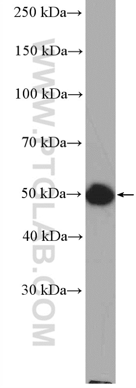 Western Blot (WB) analysis of HeLa cells using Septin 10 Polyclonal antibody (12420-1-AP)