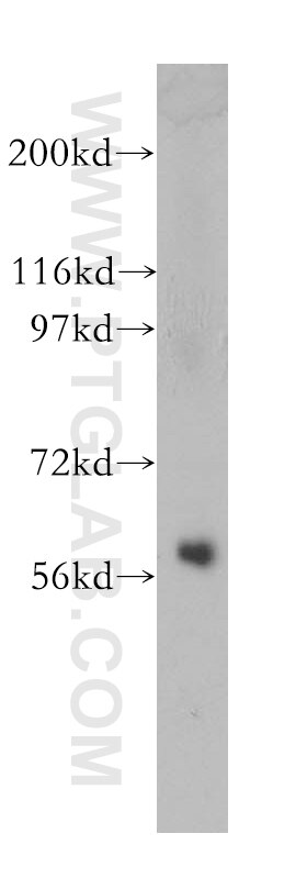 Western Blot (WB) analysis of human kidney tissue using Septin 10 Polyclonal antibody (12420-1-AP)