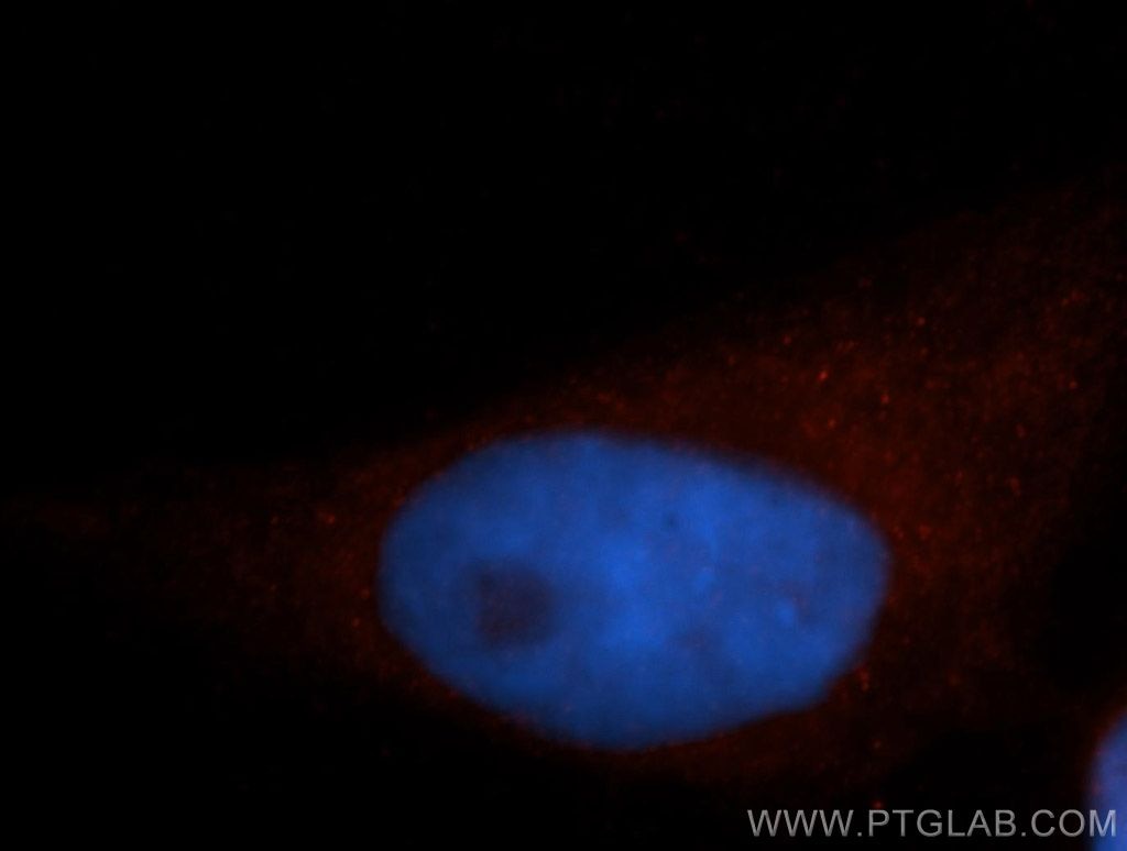 Immunofluorescence (IF) / fluorescent staining of HeLa cells using Septin 11 Polyclonal antibody (14672-1-AP)