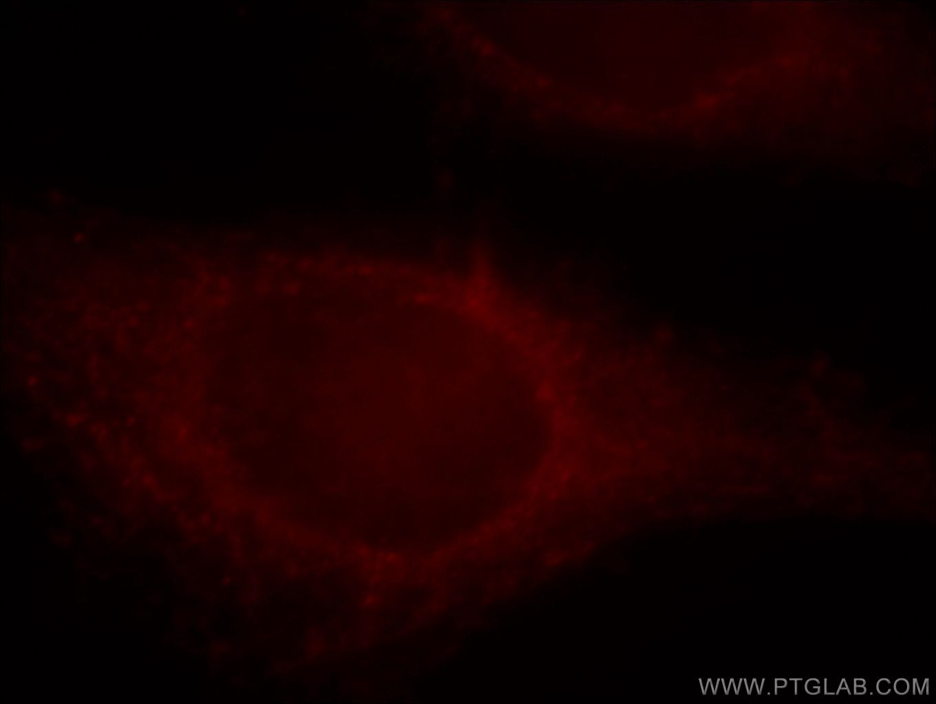 Immunofluorescence (IF) / fluorescent staining of HeLa cells using Septin 11 Polyclonal antibody (14672-1-AP)