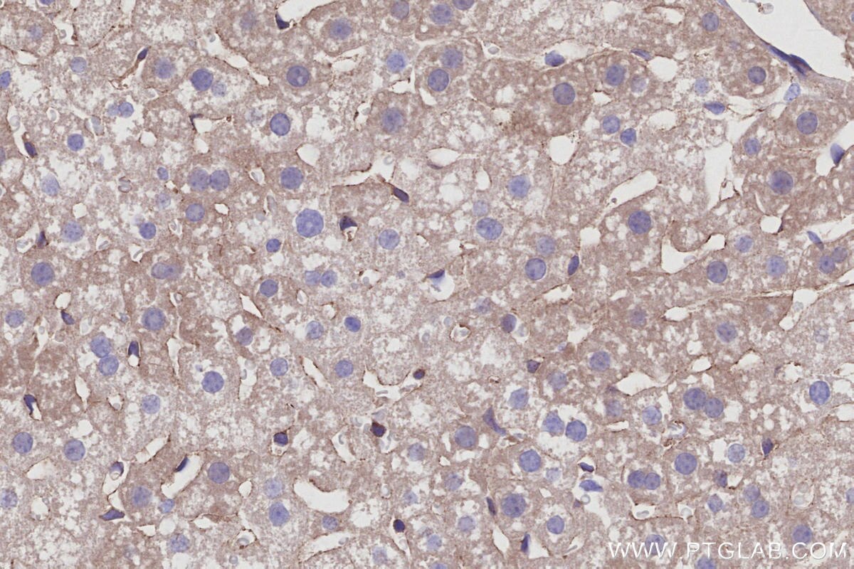 Immunohistochemistry (IHC) staining of mouse liver tissue using Septin 11 Polyclonal antibody (14672-1-AP)
