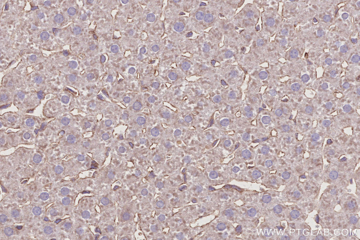 Immunohistochemistry (IHC) staining of rat liver tissue using Septin 11 Polyclonal antibody (14672-1-AP)