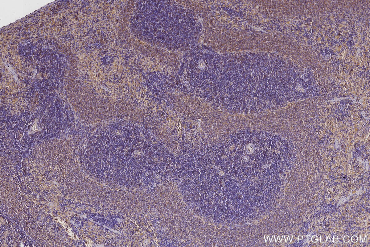 Immunohistochemistry (IHC) staining of rat spleen tissue using Septin 11 Polyclonal antibody (14672-1-AP)