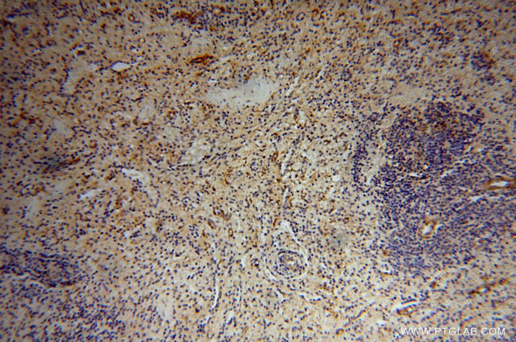 Immunohistochemistry (IHC) staining of human spleen tissue using Septin 11 Polyclonal antibody (14672-1-AP)