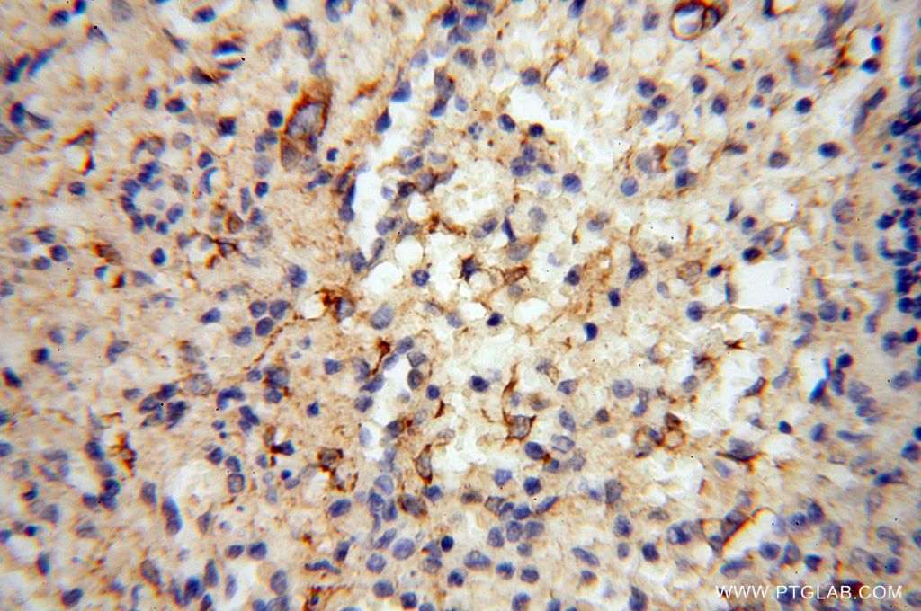 Immunohistochemistry (IHC) staining of human spleen tissue using Septin 11 Polyclonal antibody (14672-1-AP)